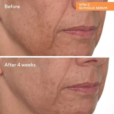 Murad Brighten & Even Tone with Vitamin C Kit