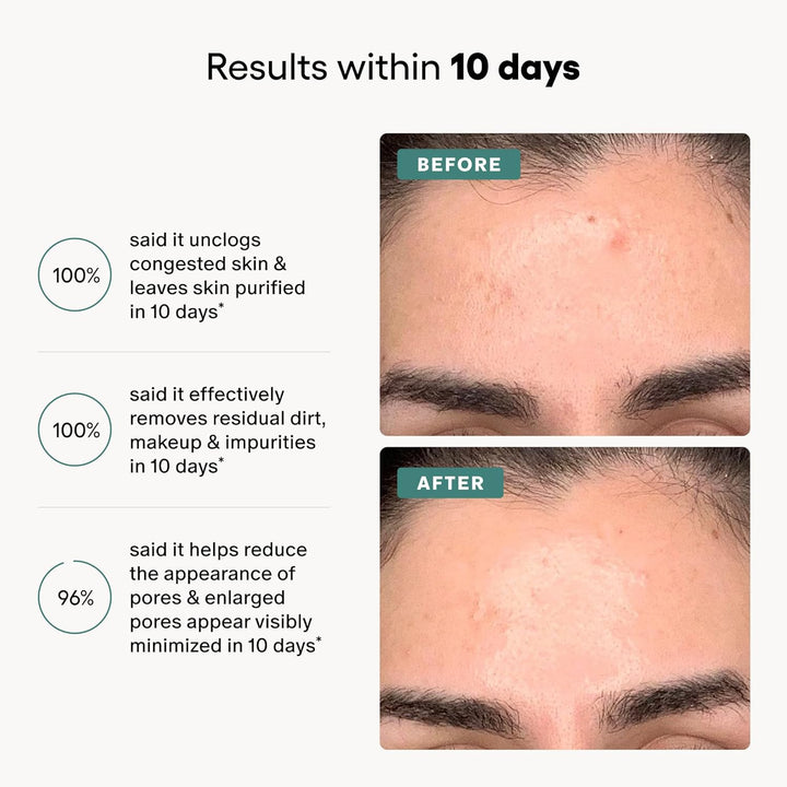 Algenist Genius Liquid Skin Resurfacing 2% BHA Toner