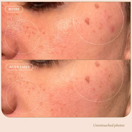 Biossance Squalane + 10% Azelaic Pore Minimizing Mask