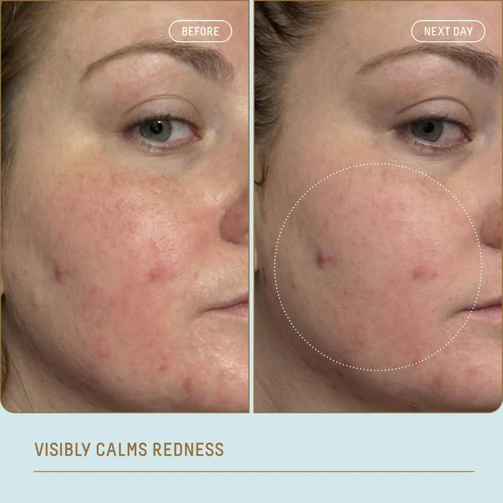 Biossance Squalane + Ectoin Overnight Rescue