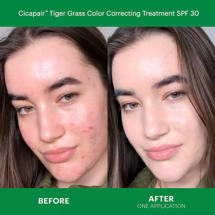 Dr. Jart+ Cica Redness Rescue Kit