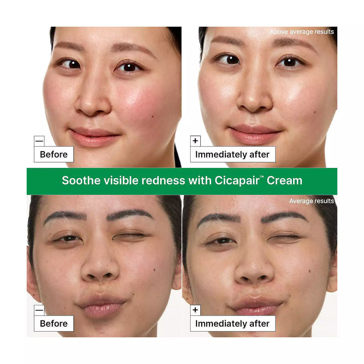 Dr. Jart+ Cica Redness Rescue Kit