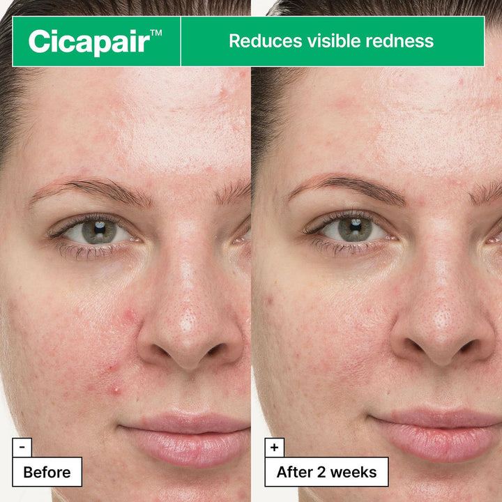 Dr. Jart+ Cicapair So Soothing Treatment