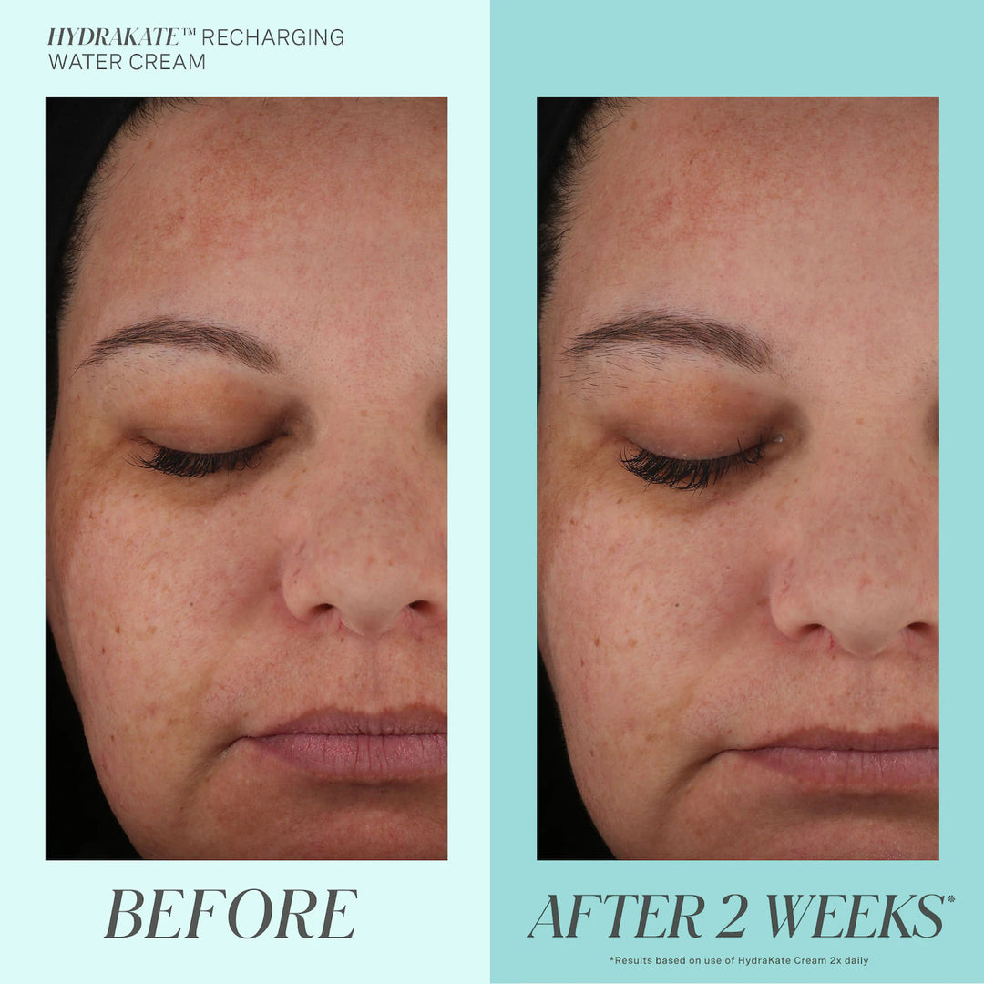 Kate Somerville Hydrakate Recharging Water Cream