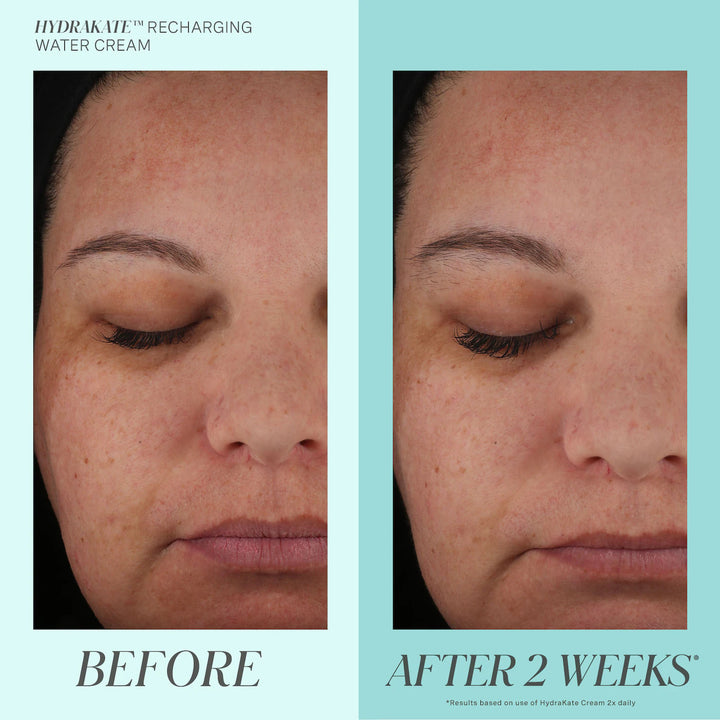 Kate Somerville Hydrakate Recharging Water Cream