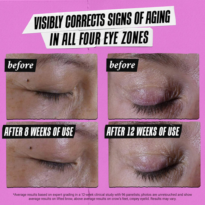 Kiehl's Super Multi-Corrective Eye Zone Treatment