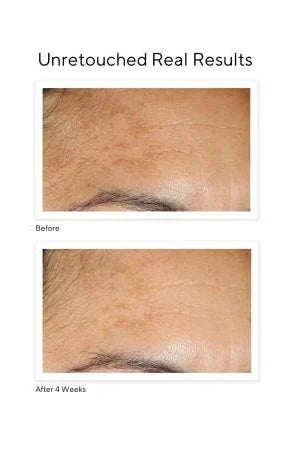 Murad Brighten & Even Tone with Vitamin C Kit