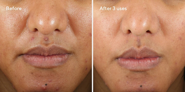 Murad Clarifying Mask