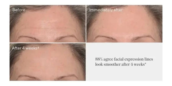 Murad Rapid Wrinkle Repair Set Retinol Youth Eye Serum & Targeted Wrinkle Corrector