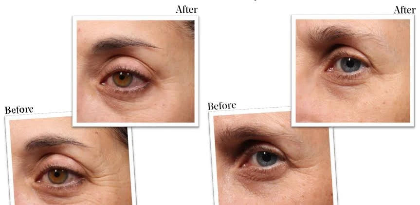 Murad Rapid Wrinkle Repair Set Retinol Youth Eye Serum & Targeted Wrinkle Corrector