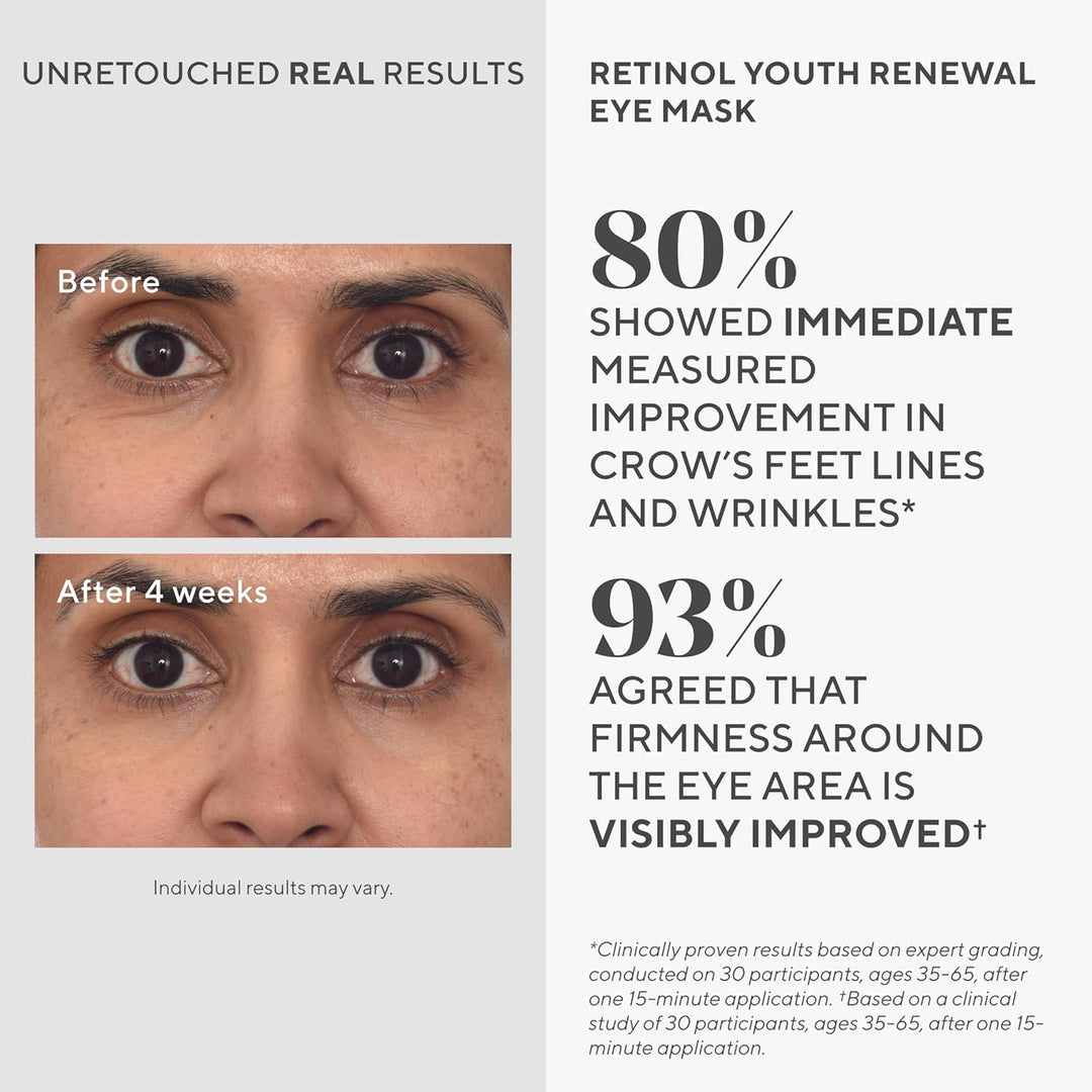 Murad Retinol Youth Renewal Eye Masks - 5pk