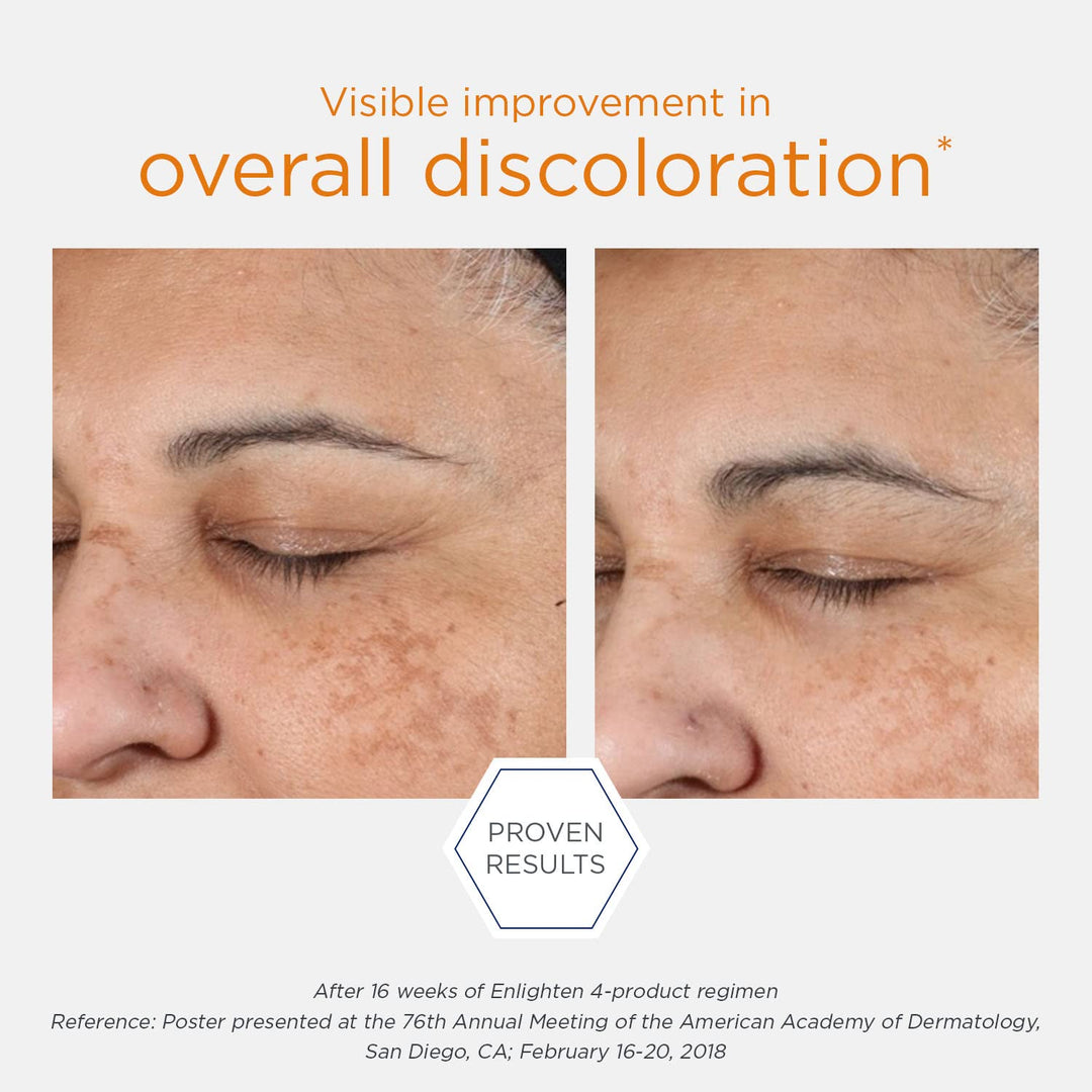 Neostrata Enlighten Pigment Controller Brightening