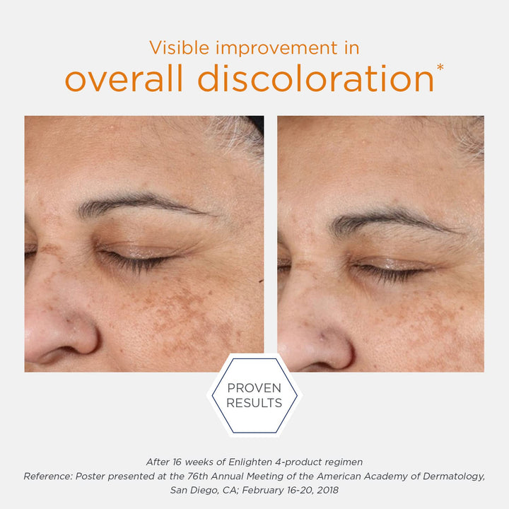 Neostrata Enlighten Pigment Controller Brightening