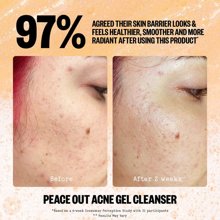 Peace Out 2% Salicylic Acid Acne Gel Cleanser