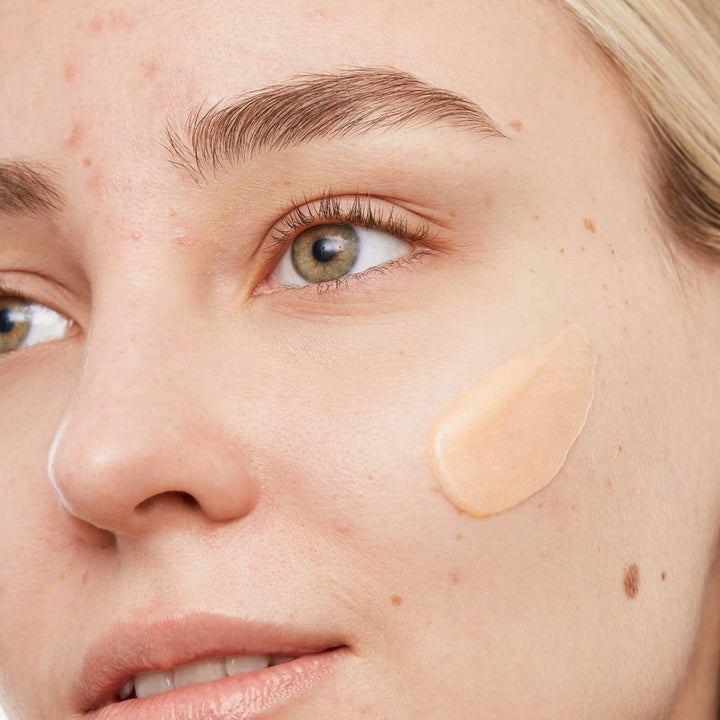 Peace Out 2% Salicylic Acid Acne Gel Cleanser