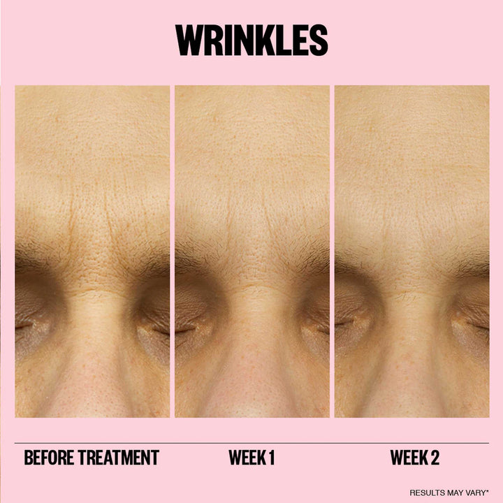 Peace Out Microneedling Anti-Wrinkle Retinol Patches - 6pk