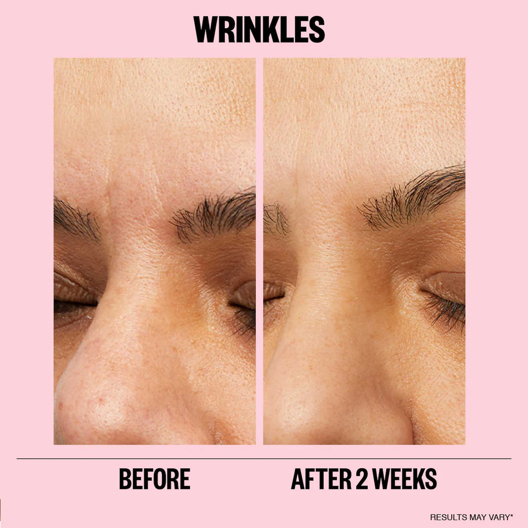 Peace Out Microneedling Anti-Wrinkle Retinol Patches - 6pk