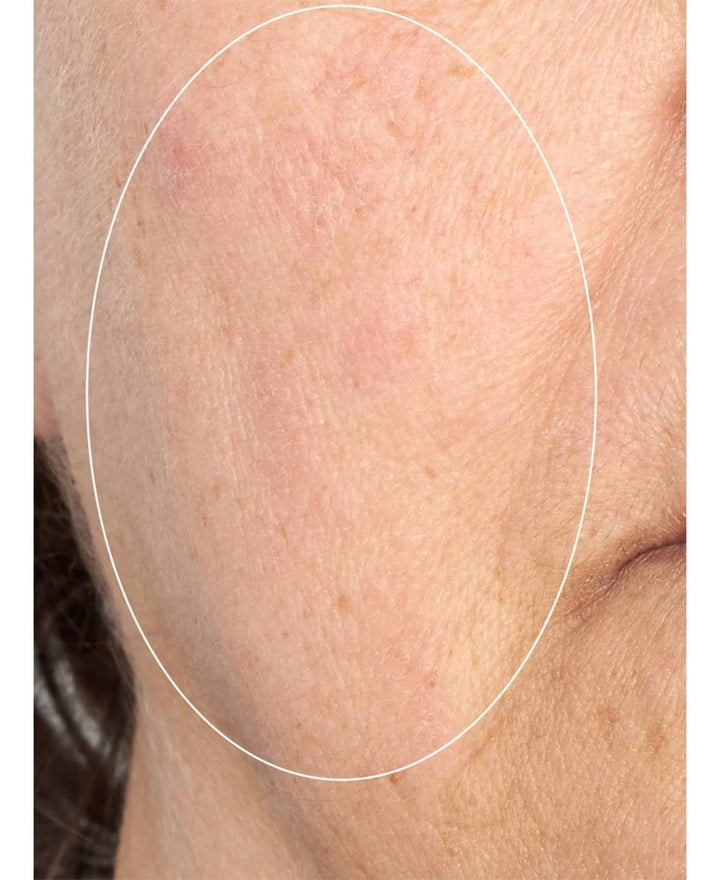 Perricone MD High Potency Intensive Smoothing Serum