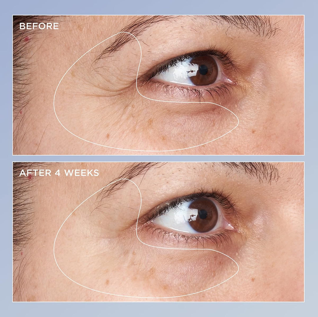 Perricone MD High Potency Triple Retinol Renewal Eye Serum