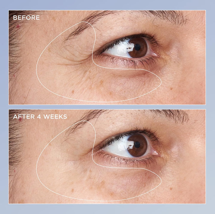 Perricone MD High Potency Triple Retinol Renewal Eye Serum