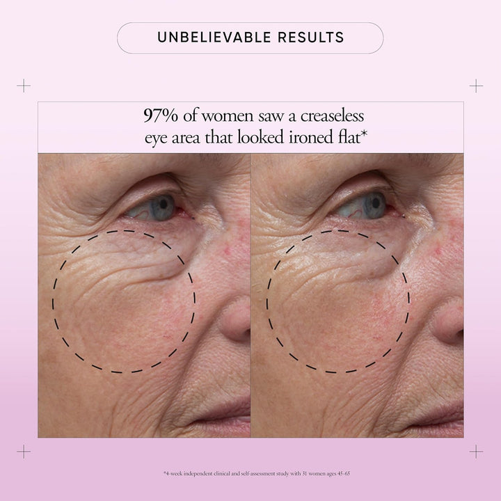 Philosophy Ultimate Miracle Worker Fix Eye Power-Treatment Fill & Firm