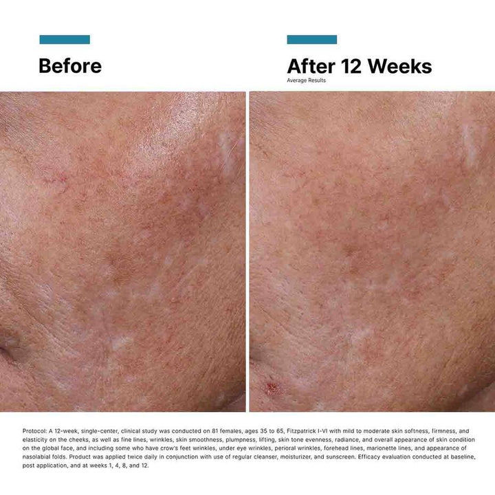 SkinCeuticals H.A. Intensifier Multi-Glycan Serum