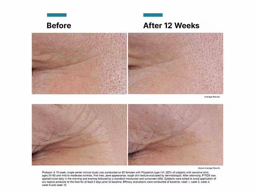 SkinCeuticals P-TIOX Peptide Serum