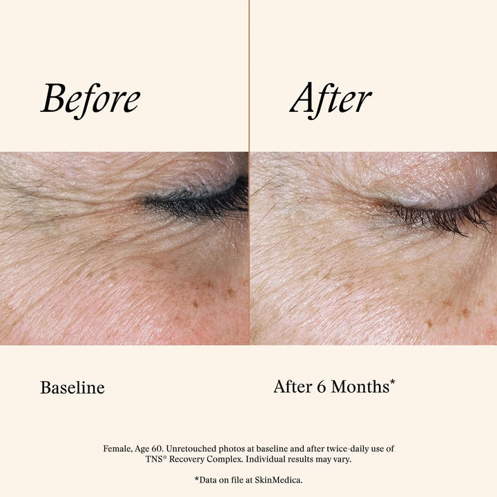 SkinMedica TNS Recovery Complex