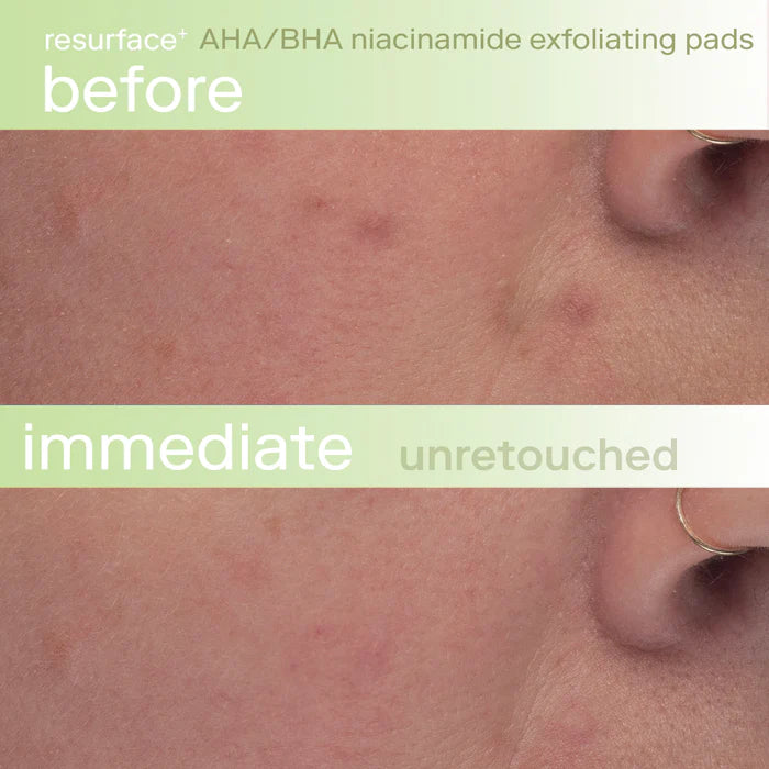 Skinfix Resurface+ AHA/BHA Niacinamide Exfoliating Pads