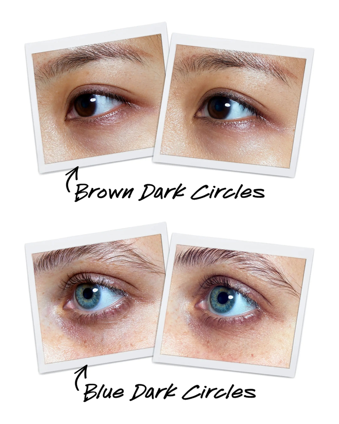 Kiehl's Powerful-Strength Dark Circle Reducing Vitamin C Eye Serum 0.5oz
