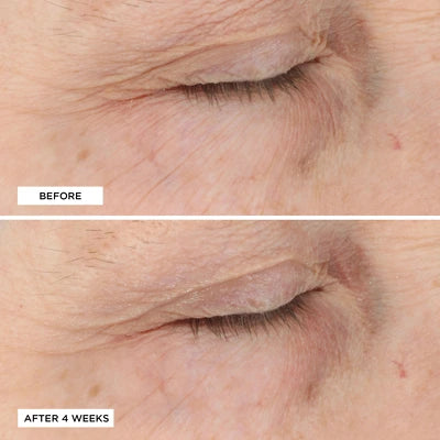 perricone md essential fx acyl glutathione rejuvenating moisturizer Acyl-Glutathione Smoothing & Brightening Under-Eye Cream Perricone md essential fx acyl