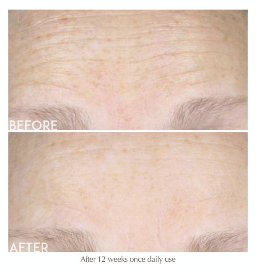 Exuviance EMPOWER Rapid De-Crease