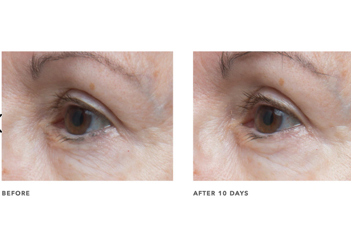 ALGENIST GENIUS Ultimate Anti-Aging Eye Cream 15ml