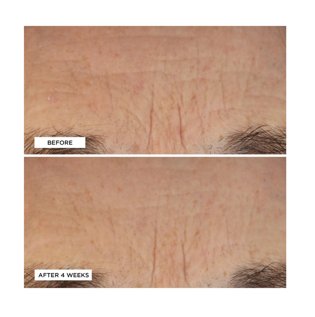 Perricone MD Essential Fx Acyl-Glutathione Deep Crease Serum Perricone MD Essential Fx Acyl-Glutathione Deep Crease Serum