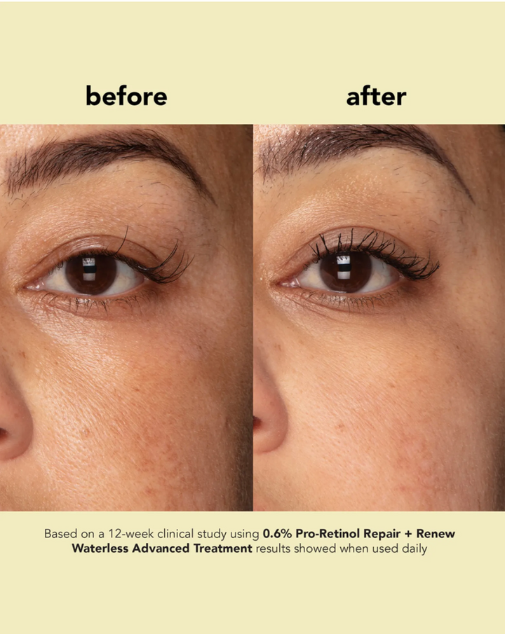 Boscia 0.6% Pro-Retinol Repair + Renew Waterless Advanced Treatment