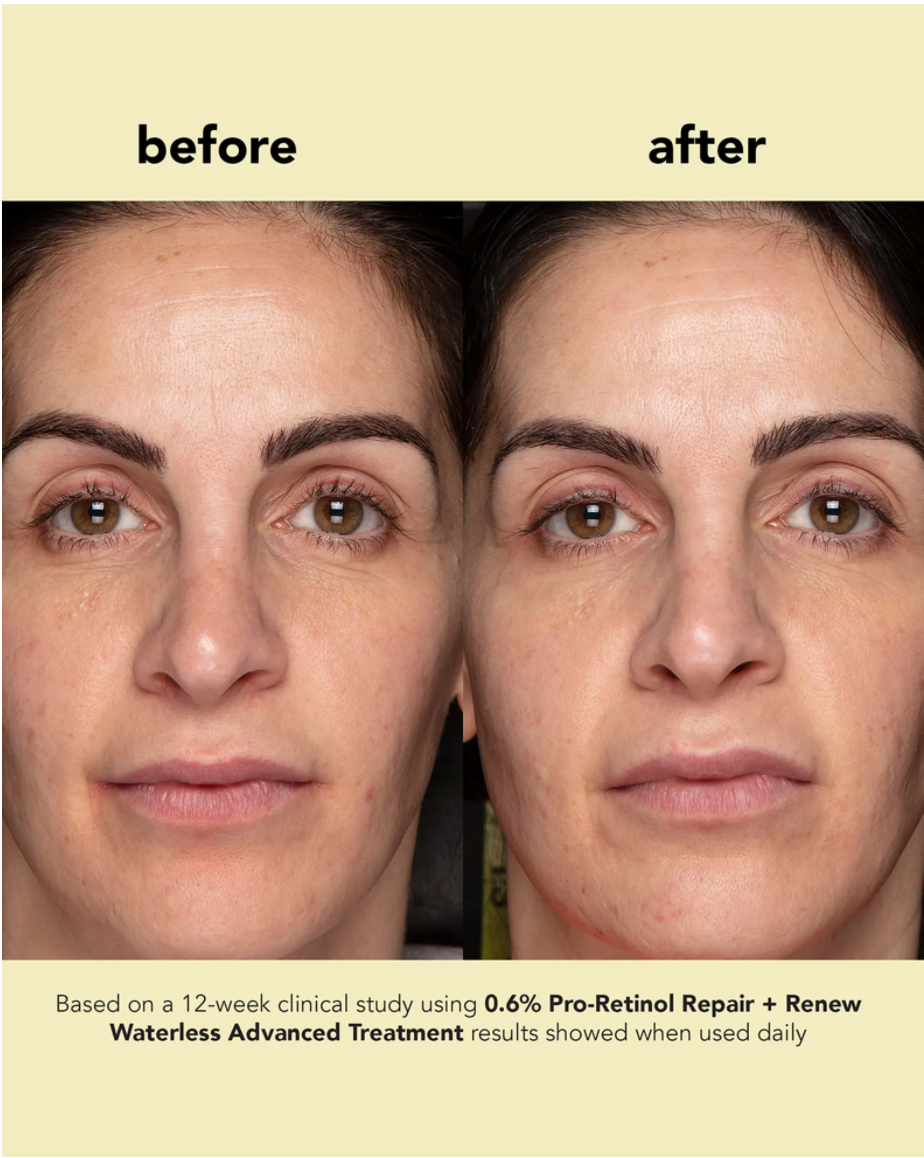 Boscia 0.6% Pro-Retinol Repair + Renew Waterless Advanced Treatment