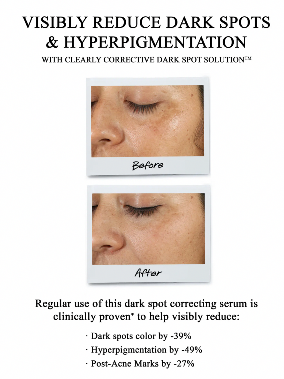 Kiehl's Clearly Corrective Dark Spot Solution Serum - 1.0 fl oz droppe –  Masters Beauty Store