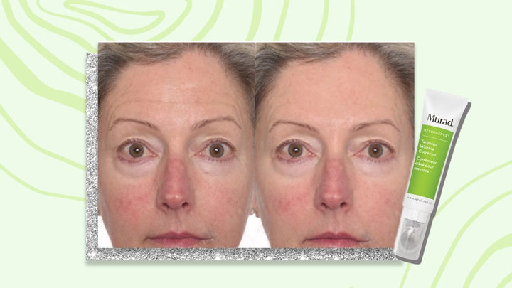 Murad Resurgence Targeted Wrinkle Corrector