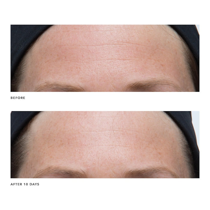 Algenist POWER Advanced Wrinkle Fighter Moisturizer