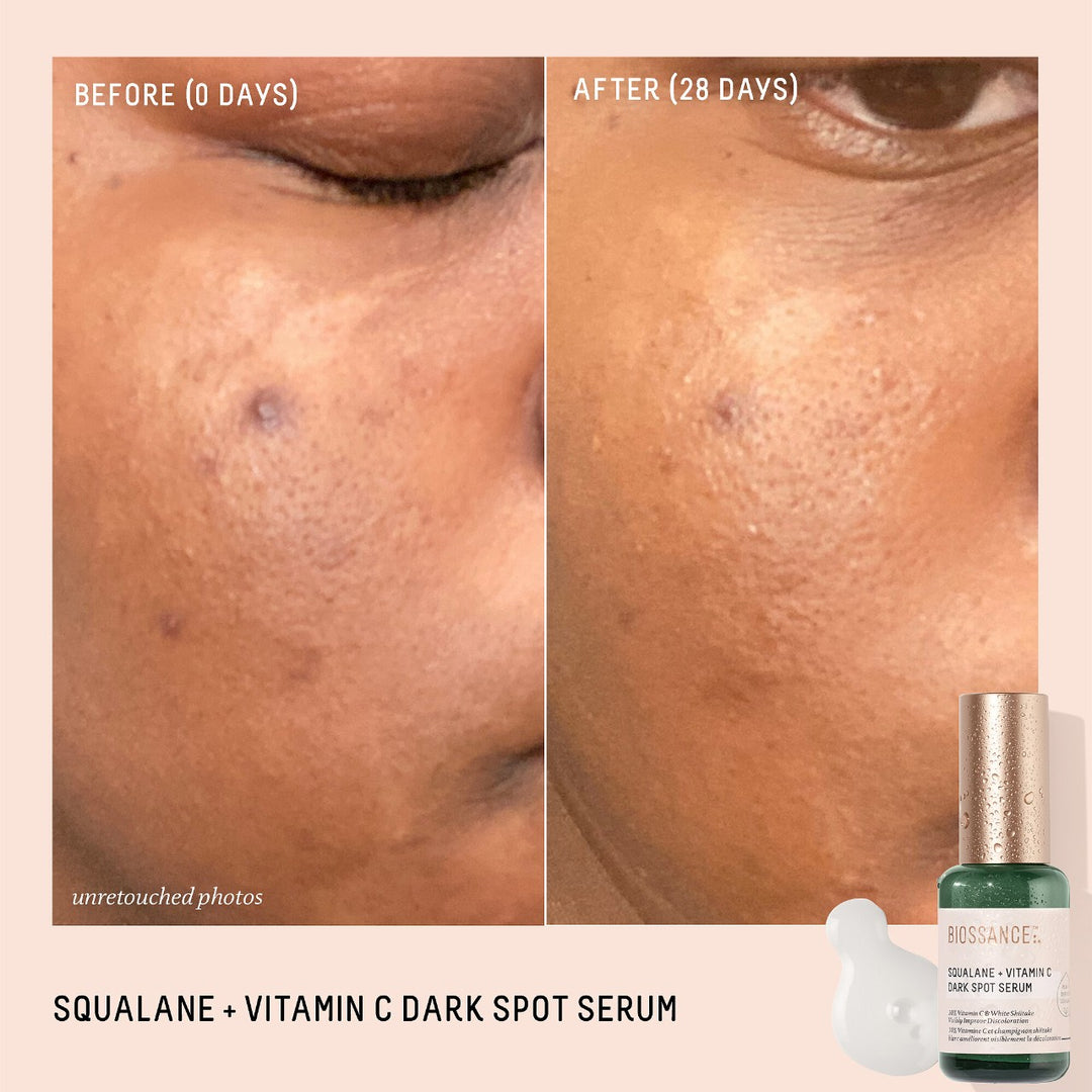 Biossance Squalane + 10% Vitamin C Dark Spot Serum 1.0 oz