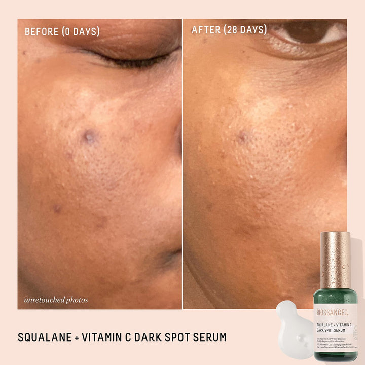 Biossance Squalane + Vitamin C Dark Spot Serum